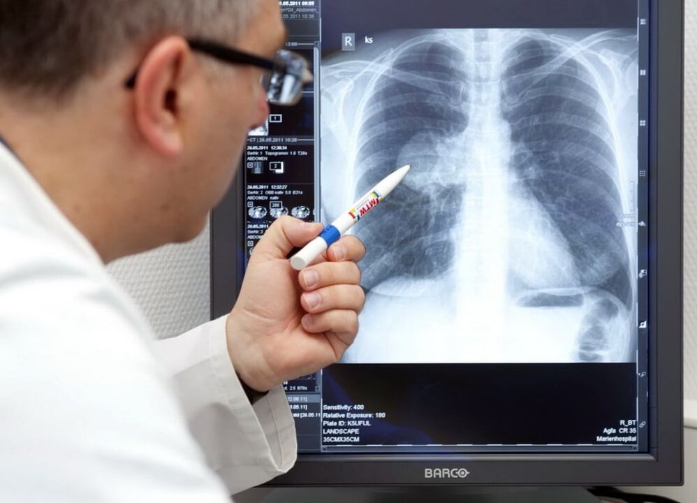 diagnostic d'hypertension artérielle